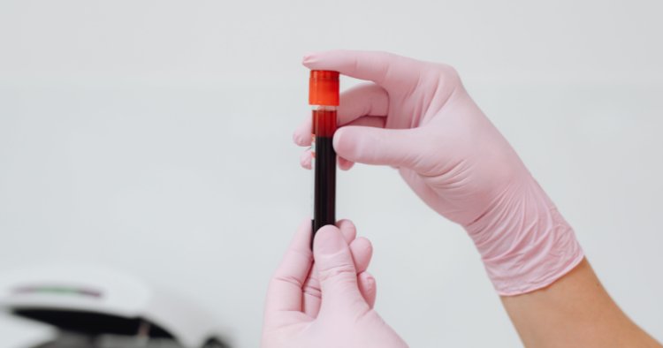 Golongan Darah P yang Sangat Langka Ditemukan di China