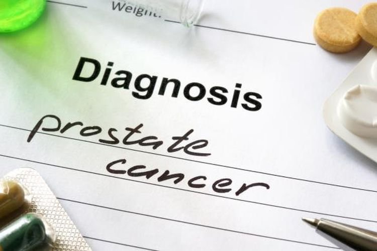 6 Langkah "Cerdik" Kurangi Risiko Kanker Prostat, Apa Saja?