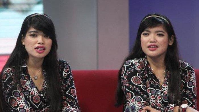 Ingat Yuliana Yuliani? Bayi Kembar Siam Pertama Berhasil Dioperasi di Indonesia,Kabarnya Sekarang
