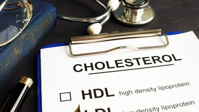 Dokter Jantung Beberkan Makanan yang Perlu Dihindari Pengidap Kolesterol Tinggi