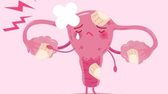 Ovarium Kiky Saputri Diangkat karena Kista,dr. Zaidul Akbar Ingatkan Wanita Menghindari Makanan Ini