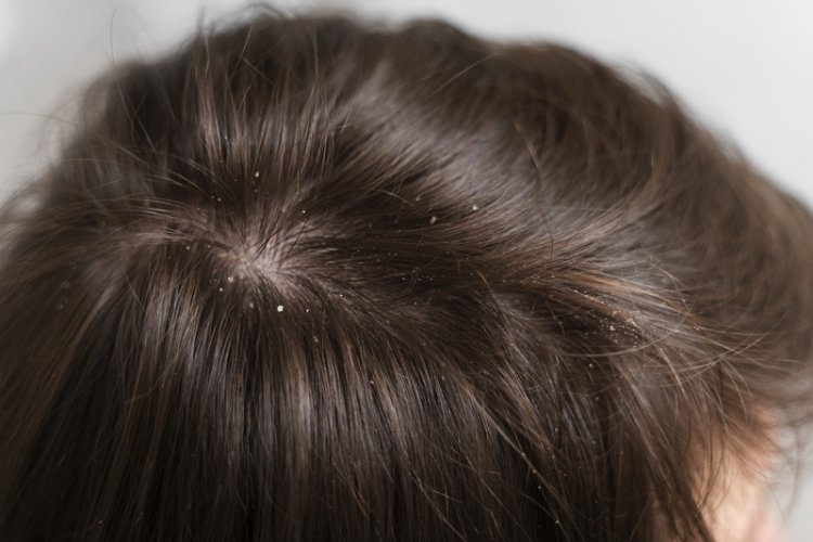 Ketahui 6 Manfaat Minyak Zaitun untuk Rambut!